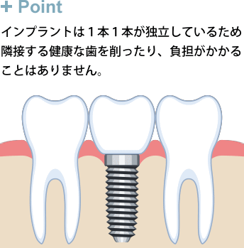 インプラントは１本１本が独立しているため 隣接する健康な歯を削ったり、負担がかかる ことはありません。